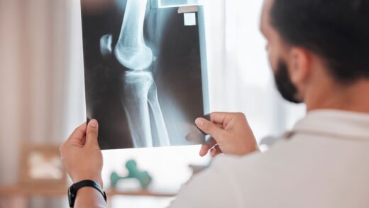 Lekarz oglądający prześwietlenie